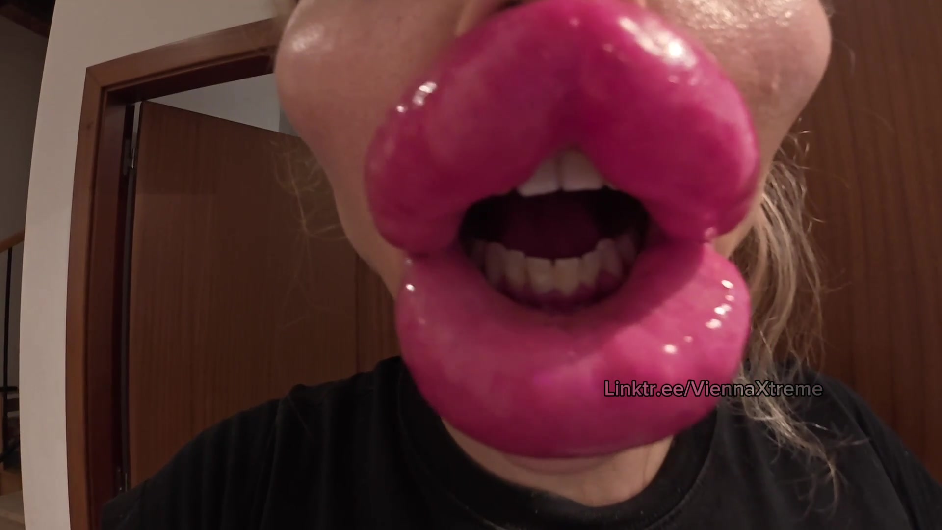 Showing you my new Lips after getting over 17cc pumped into them - free porn video