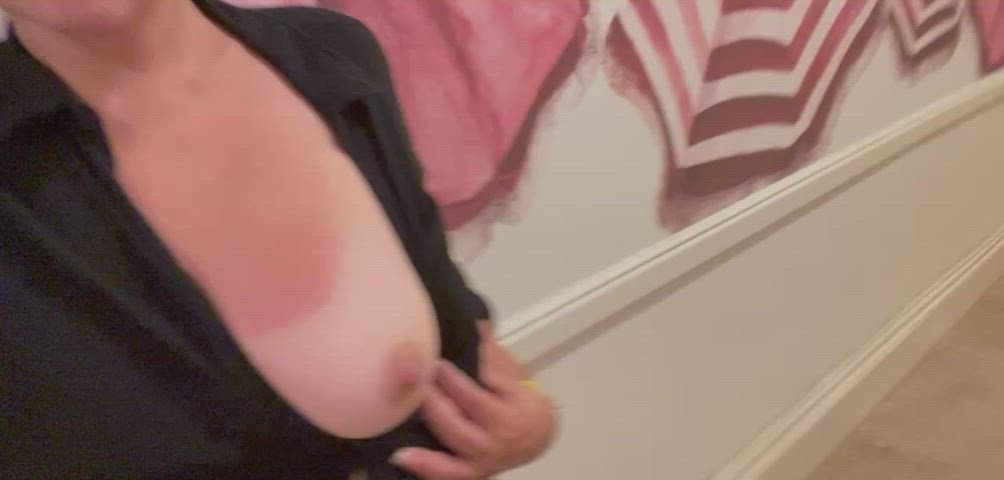 I love this hotel 🏨 so classic. My poor sunburned titties the same color as wall. [GIF] - free porn video